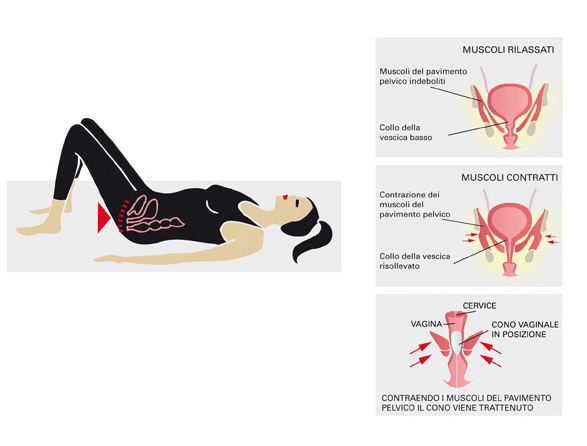 Riabilitazione del Pavimento Pelvico - Galeno Fisioterapia e Riabilitazione